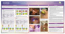 Bilateral Repeat Corneal Cross Linking on a Progressive Keratoconus Patient